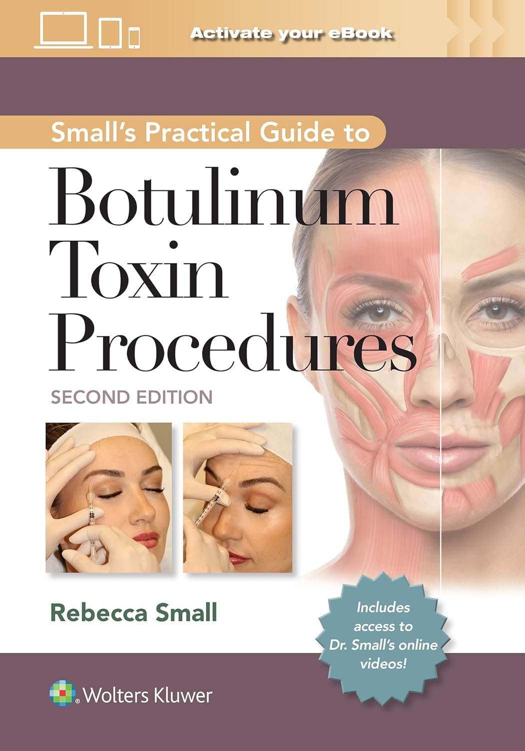 Small's Practical Guide to Botulinum Toxin Procedures-2판