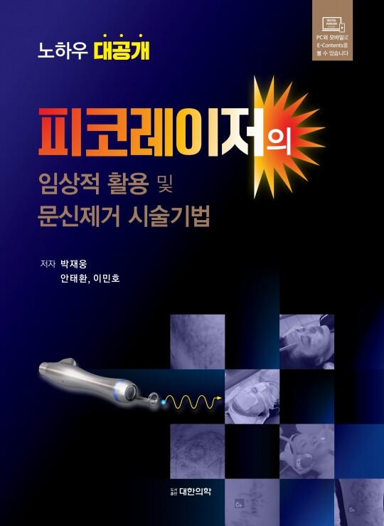 피코레이저의 임상적 활용 및 문신제거 시술기법