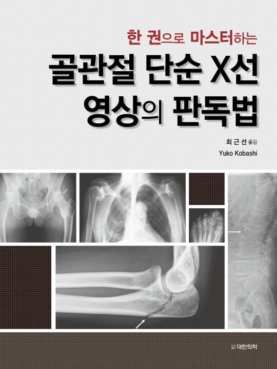 한 권으로 마스터하는 골관절 단순X선 영상의 판독법