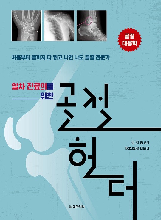 일차 진료의를 위한 골절 헌터