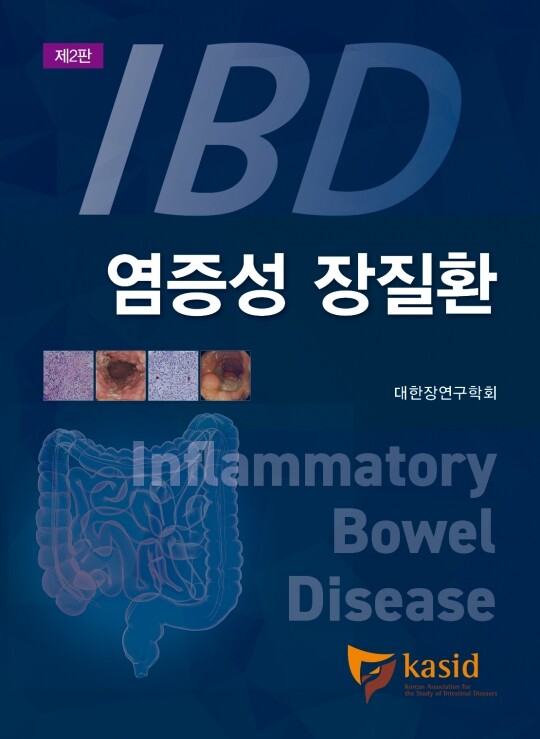 염증성 장질환 - 2판