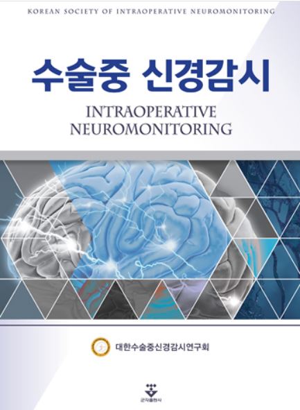 수술중 신경감시
