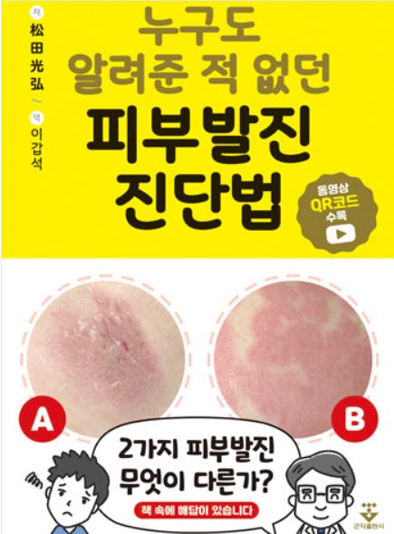 누구도 알려준 적 없던 피부발진 진단법