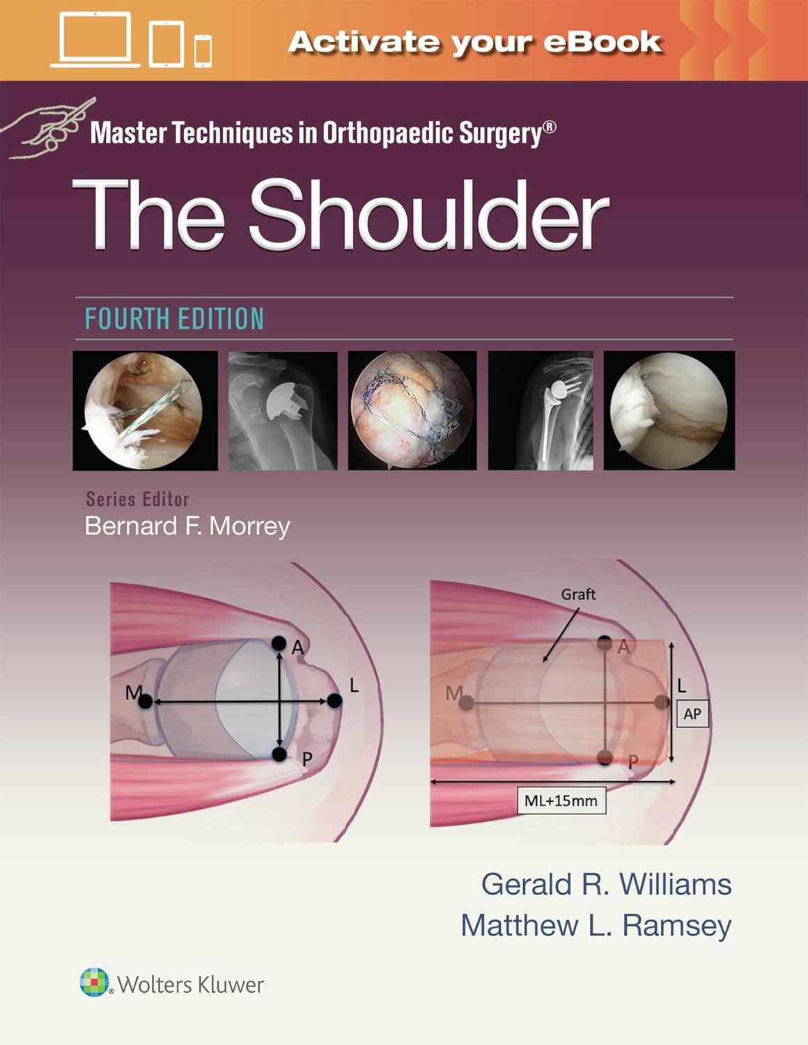Master Techniques in Orthopaedic Surgery : The Shoulder - 4판