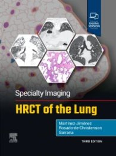 Specialty Imaging: HRCT of the Lung - 3판