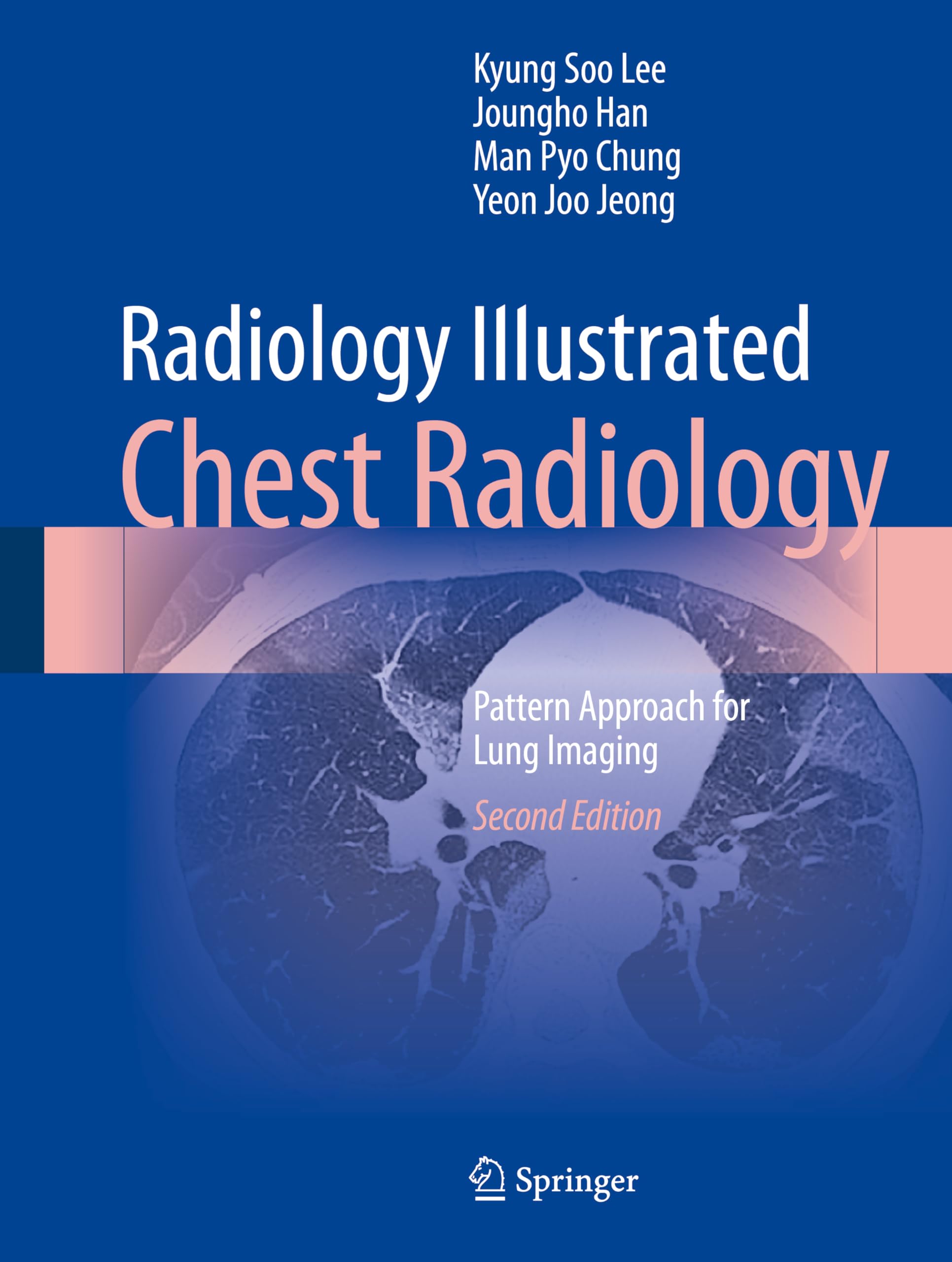 Radiology Illustrated: Chest Radiology-2판