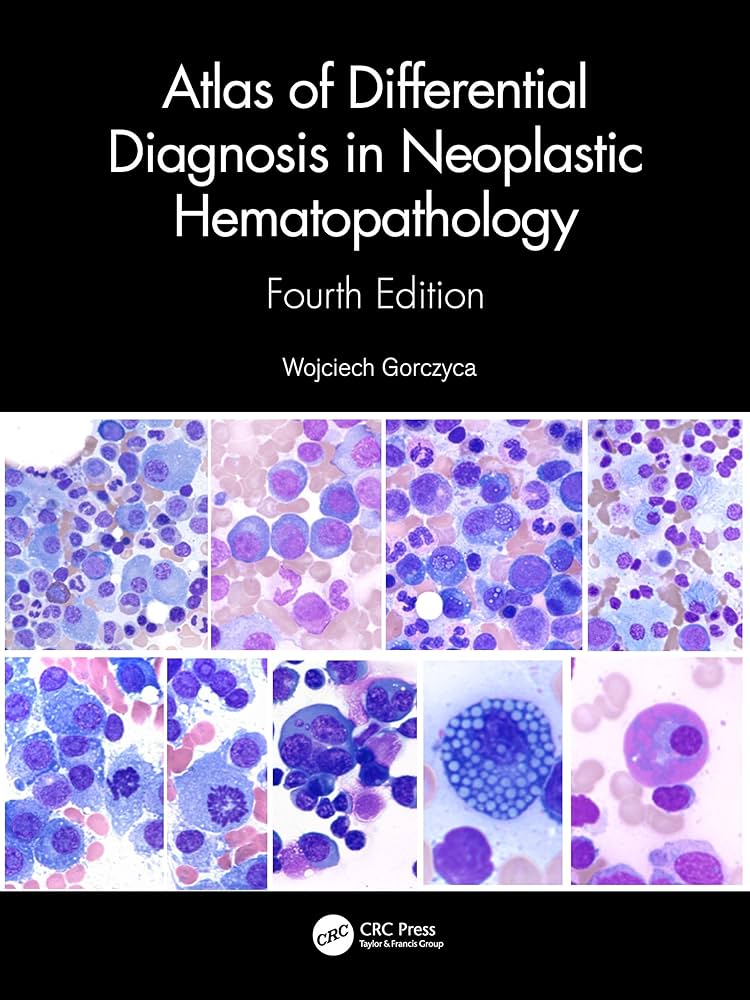 Atlas of Differential Diagnosis in Neoplastic Hematopathology-4판