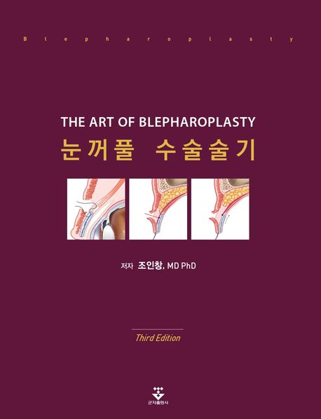 눈꺼풀 수술술기-3판