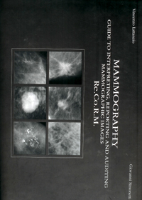Mammography : Guide to Interpreting Reporting and Auditing Mammographic Images