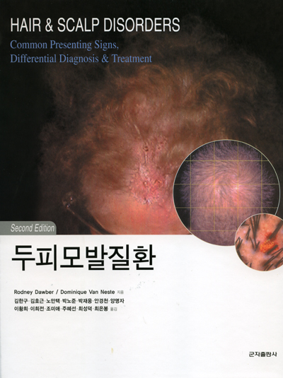 두피모발질환