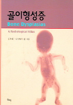 골이형성증