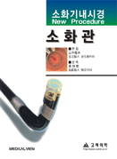 소화기내시경(소화관)