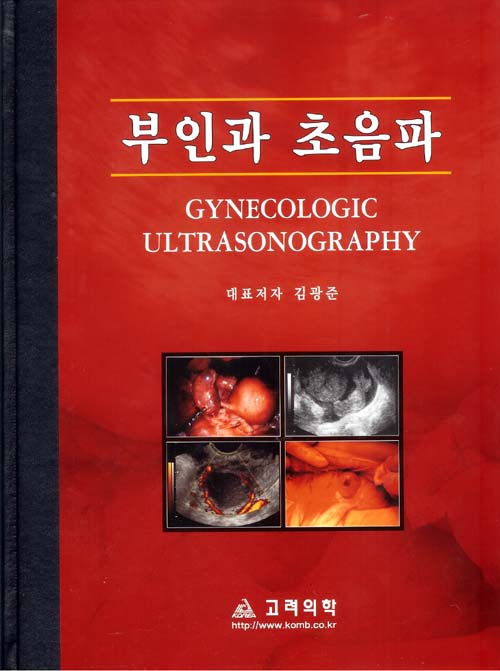 부인과초음파