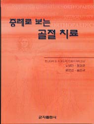 증례로 보는 골절 치료