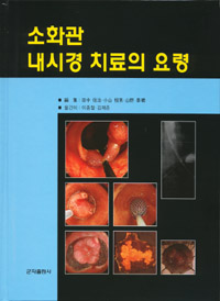 소화관 내시경 치료의 요령