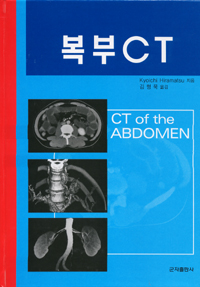 복부CT (CT of the ABDOMEN)