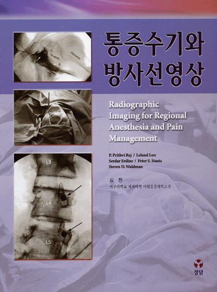 통증수기와 방사선영상