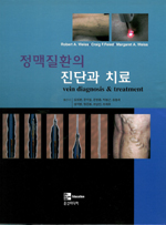 정맥질환의 진단과 치료
