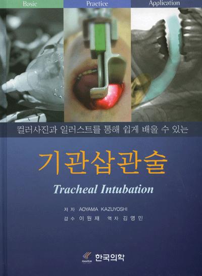 기관삽관술(컬러사진과 일러스트를 통해 쉽게 배울 수 있는)
