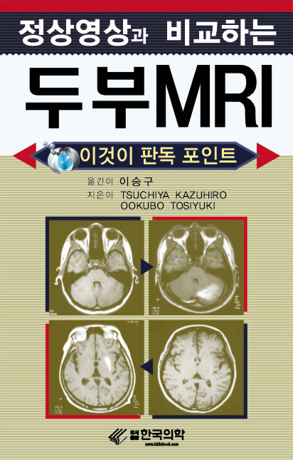 정상영상과 비교하는 두부MRI