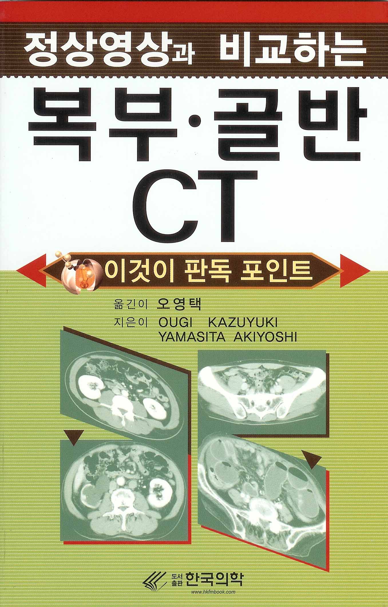 정상영상과 비교하는 복부 골반 CT