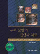 두피모발의 진단과치료 모발이식술과 탈모증진단(동영상포함)