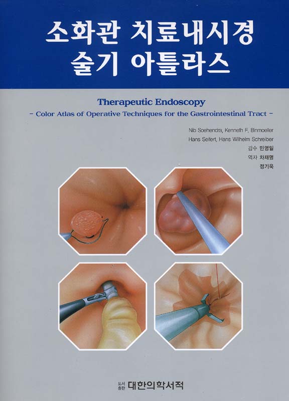 소화관 치료내시경 술기 아틀라스