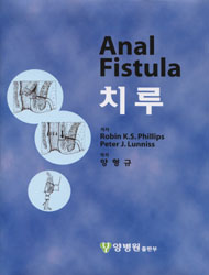 치루