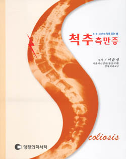 척추측만증