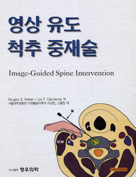 영상유도 척추 중재술