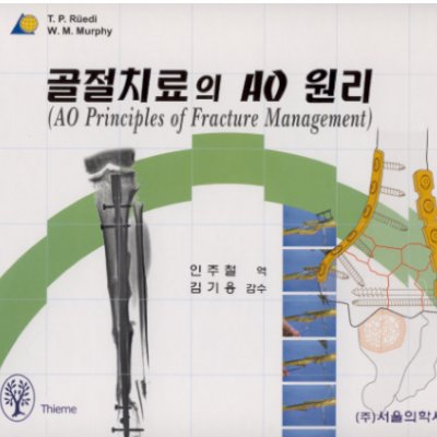 골절치료의 AO 원리