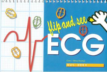 ECG