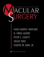 Macular Surgery