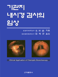 기관지 내시경검사의 임상