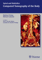 Spiral and Multislice Computed Tomography of the Body