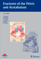Fractures of the Pelvis and Acetabulum